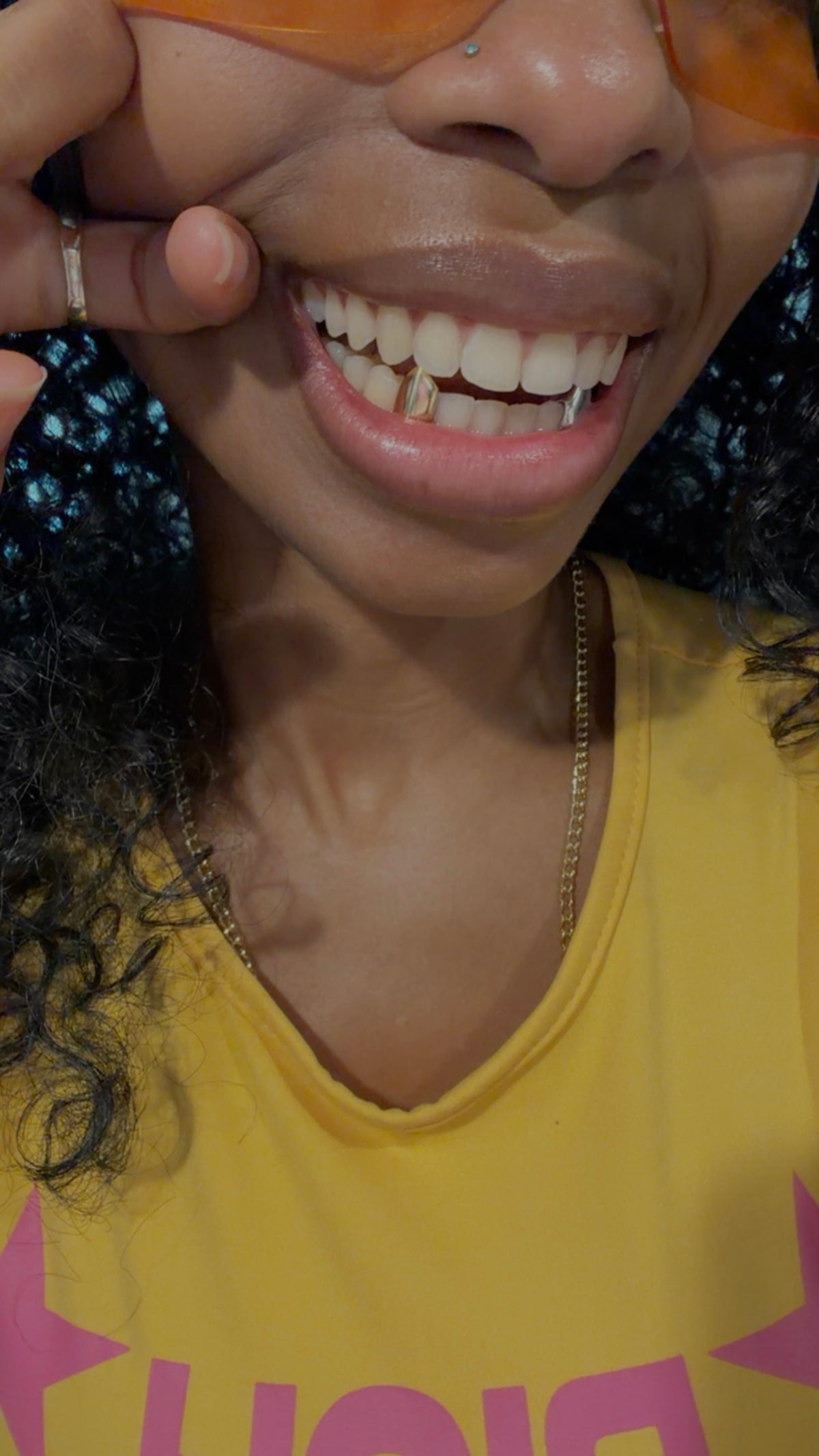Custom gold grillz by Statement92 worn in a lifestyle portrait